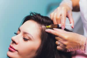 A woman getting a PRP injection in her scalp