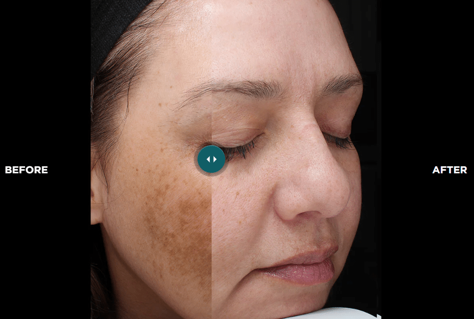 VI Peel in San Diego